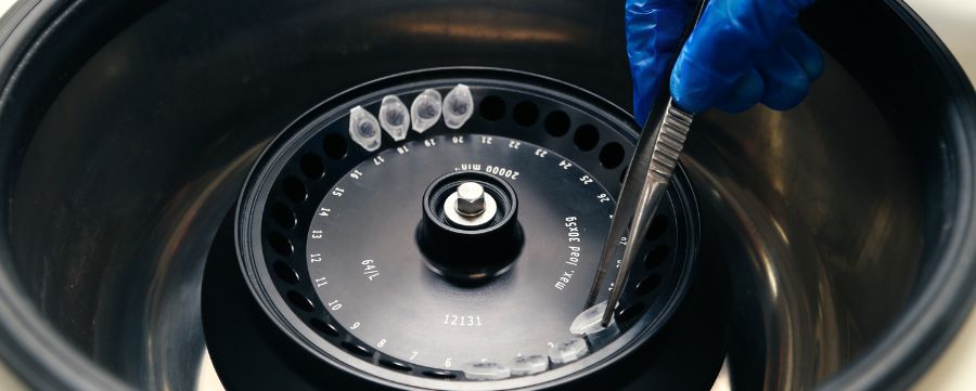 Centrifugación de muestras