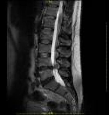 NUEVO: COMPRA TUS PRUEBAS DE DIAGNÓSTICO POR LA IMAGEN AHORA MÁS FÁCIL